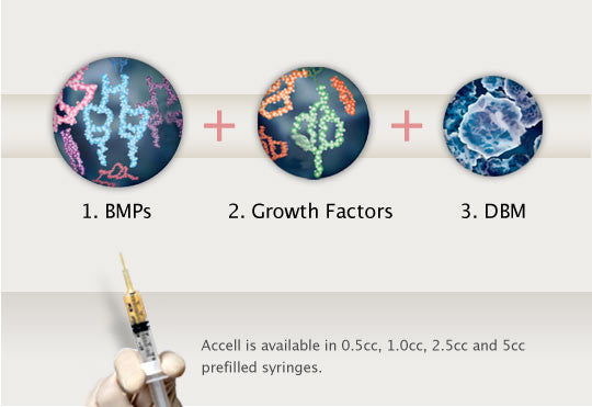 Accell Connexus DBM Bone Graft Substitute With BMPs 2.5cc