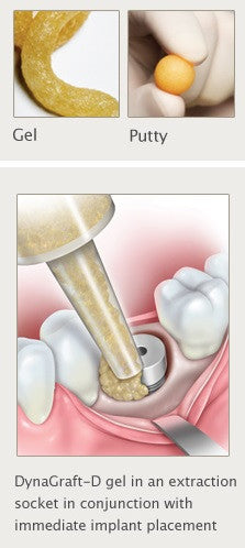 DynaGraft - D パテ 5.0cc