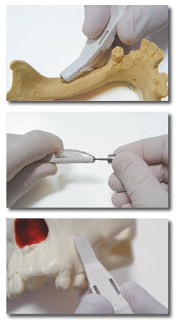 Osseous Glider (アングル) (BG205)