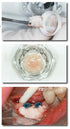 Bone Collector (10個入り) (BC100)