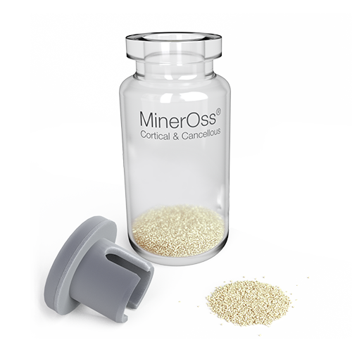 MinerOss Cortical & Cancellous Chips 1.0cc