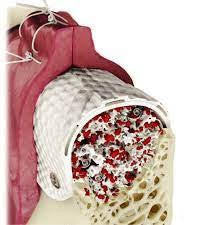 CYTOPLAST TXT-200