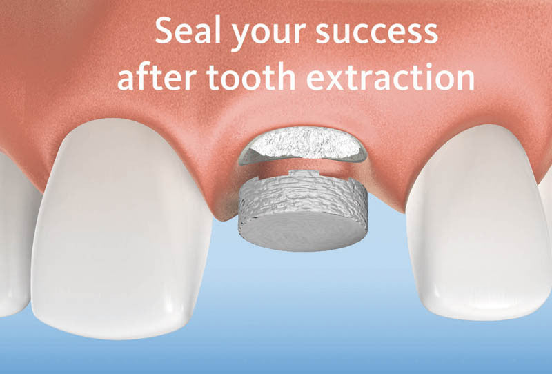 Mucograft Seal 8mm