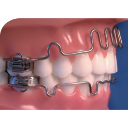 Lip Bumper Upper Large