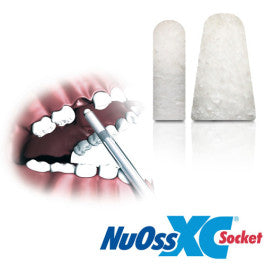 NuOss XC ソケット 6 x 15mm